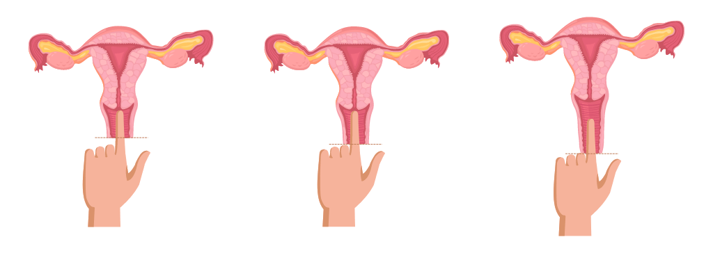 Carmen Lorenzana – How to choose the best menstrual cup Carmen Lorenzana - How to choose the best menstrual cup